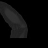 SPORK, NICO - 22.03.1976 - 02.08.2022 - CT obere Extremität - 18:01:46